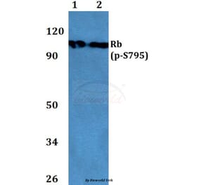 Anti-Rb (phospho-S795) Antibody from Bioworld Technology (BS4165) - Antibodies.com