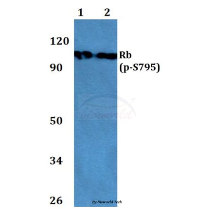 Anti-Rb (phospho-S795) Antibody from Bioworld Technology (BS4165) - Antibodies.com