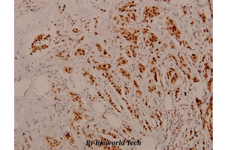 Anti-Rb (phospho-S795) Antibody from Bioworld Technology (BS4165) - Antibodies.com