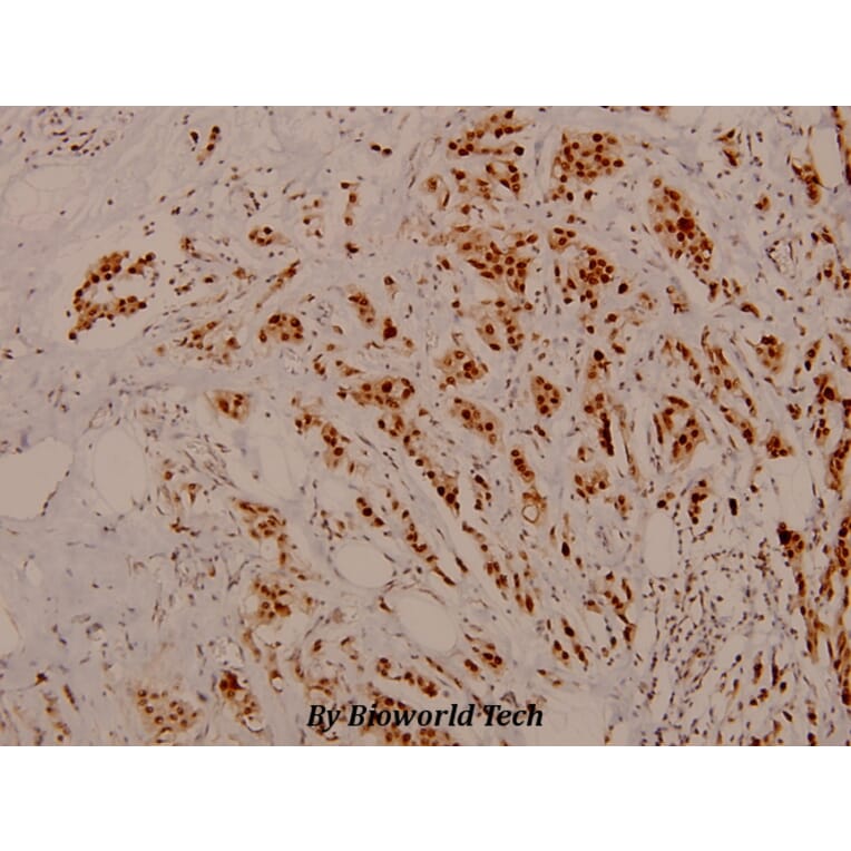 Anti-Rb (phospho-S795) Antibody from Bioworld Technology (BS4165) - Antibodies.com