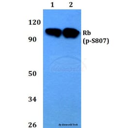 Anti-Rb (phospho-S807) Antibody from Bioworld Technology (BS4166) - Antibodies.com