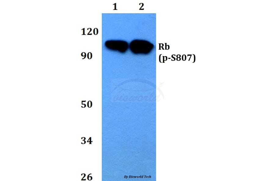 Anti-Rb (phospho-S807) Antibody from Bioworld Technology (BS4166) - Antibodies.com