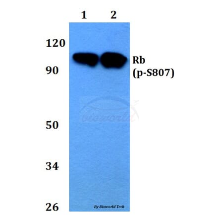 Anti-Rb (phospho-S807) Antibody from Bioworld Technology (BS4166) - Antibodies.com