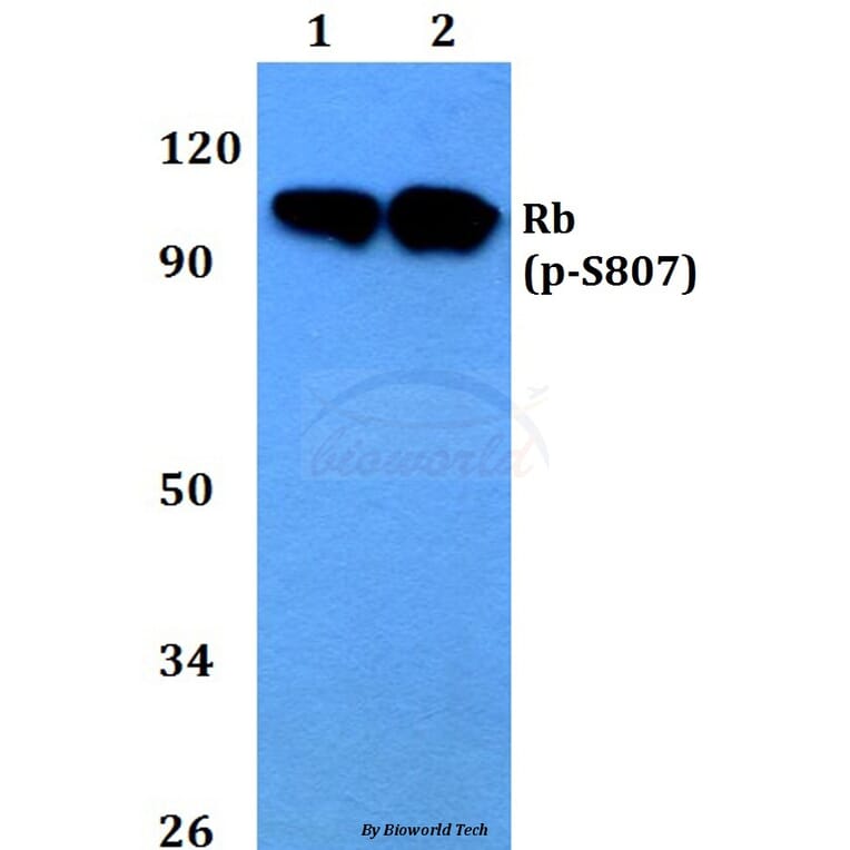 Anti-Rb (phospho-S807) Antibody from Bioworld Technology (BS4166) - Antibodies.com