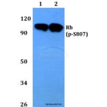 Anti-Rb (phospho-S807) Antibody from Bioworld Technology (BS4166) - Antibodies.com