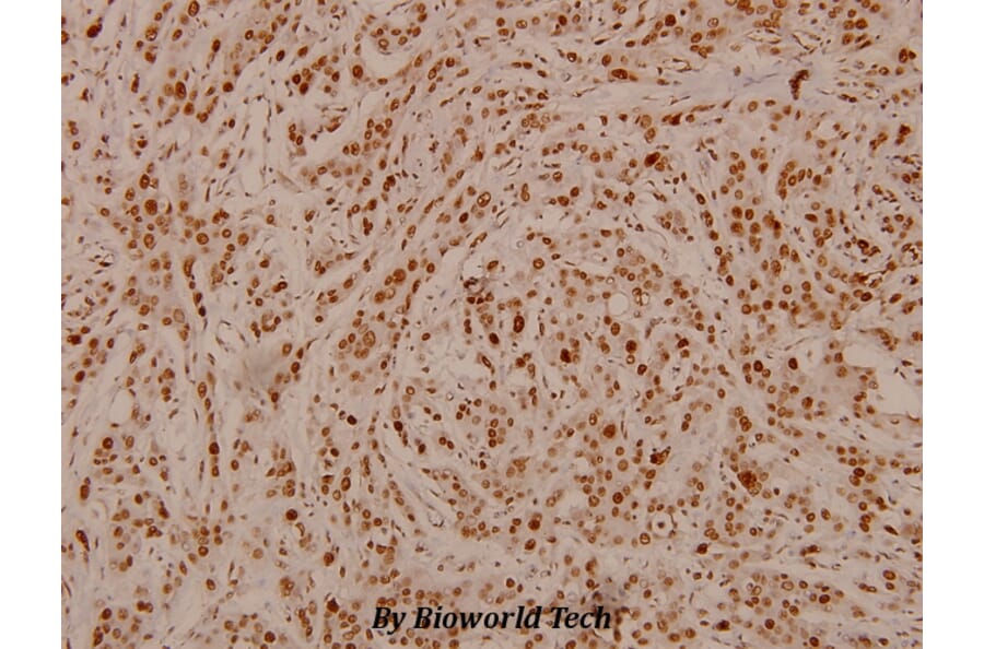 Anti-Rb (phospho-S807) Antibody from Bioworld Technology (BS4166) - Antibodies.com