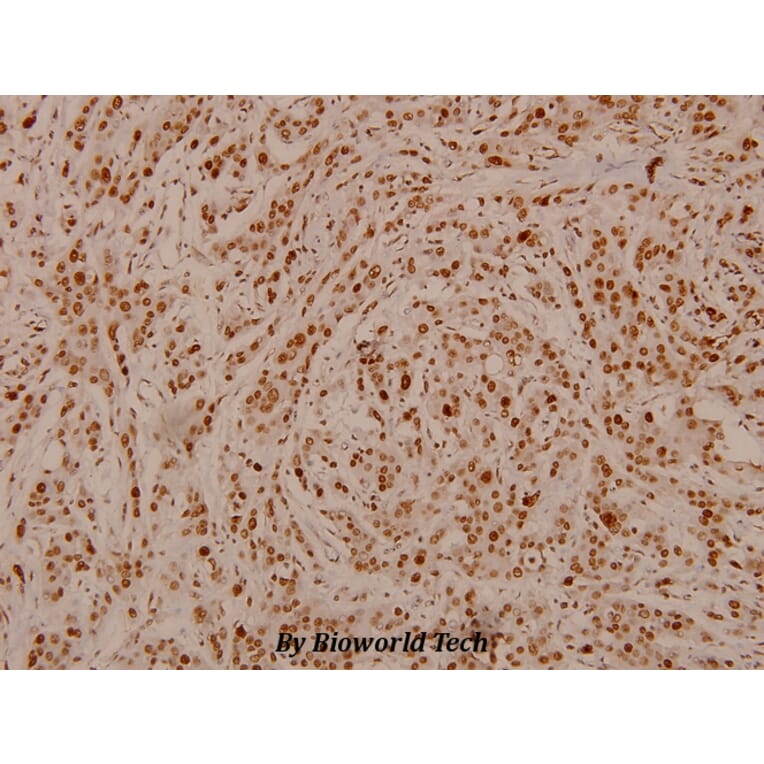 Anti-Rb (phospho-S807) Antibody from Bioworld Technology (BS4166) - Antibodies.com