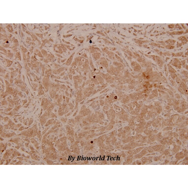Anti-MEK-4/ MAP2K4 (phospho-T261) Antibody from Bioworld Technology (BS4168) - Antibodies.com