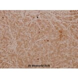 Anti-MEK-4/ MAP2K4 (phospho-T261) Antibody from Bioworld Technology (BS4168) - Antibodies.com