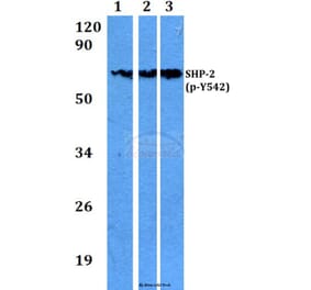 Anti-SHP-2 (phospho-Y542) Antibody from Bioworld Technology (BS4170) - Antibodies.com