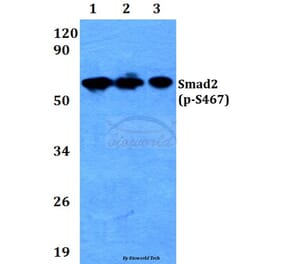 Anti-Smad2 (phospho-S467) Antibody from Bioworld Technology (BS4172) - Antibodies.com