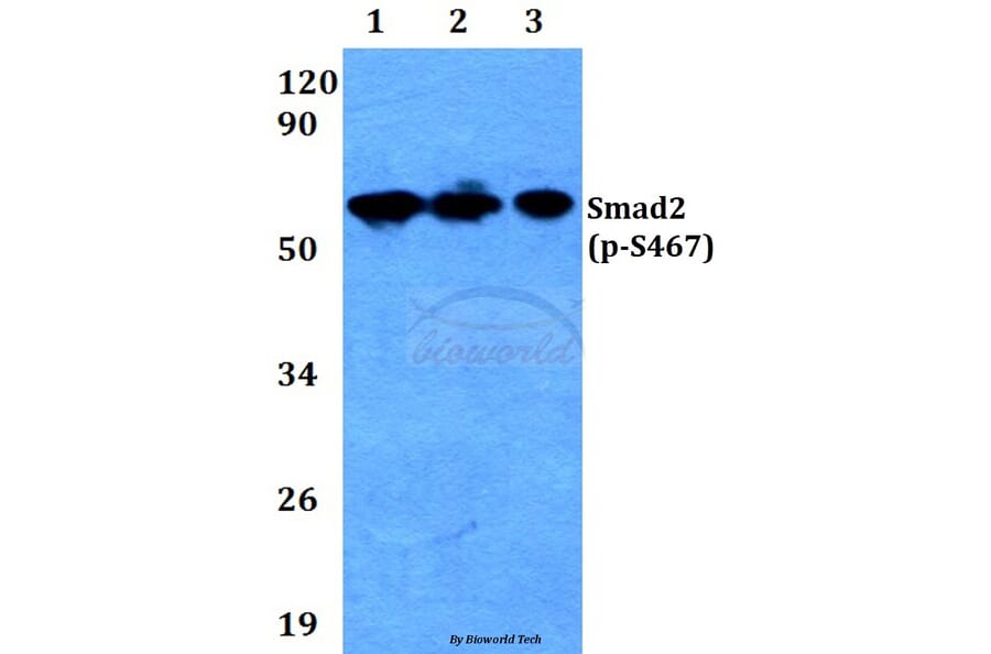 Anti-Smad2 (phospho-S467) Antibody from Bioworld Technology (BS4172) - Antibodies.com