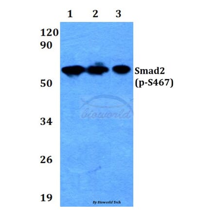 Anti-Smad2 (phospho-S467) Antibody from Bioworld Technology (BS4172) - Antibodies.com