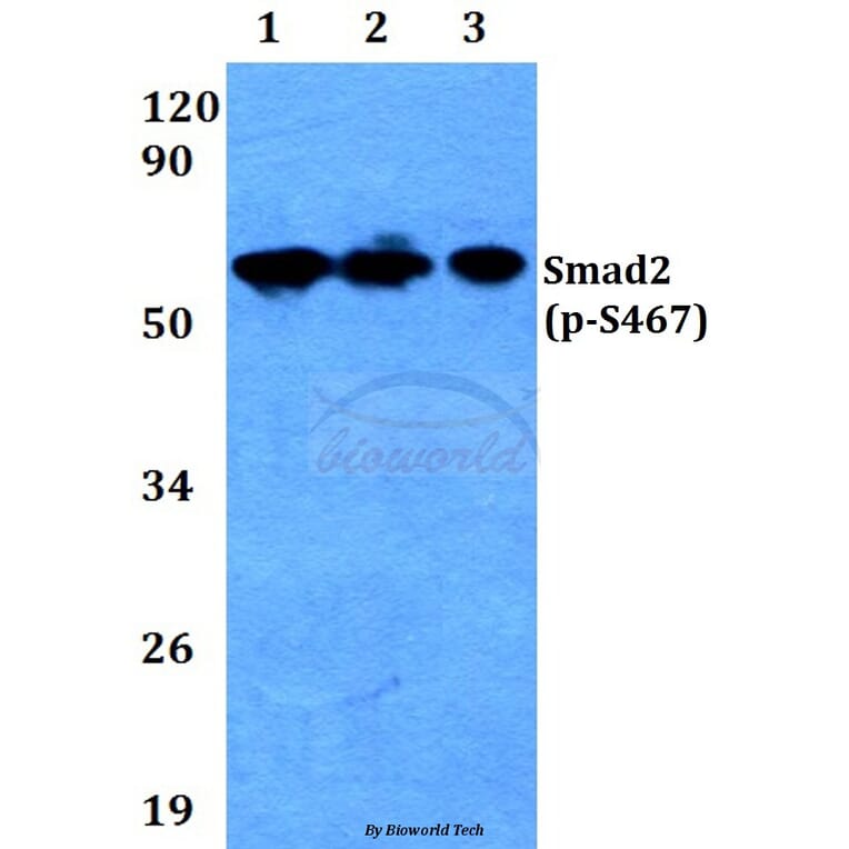 Anti-Smad2 (phospho-S467) Antibody from Bioworld Technology (BS4172) - Antibodies.com