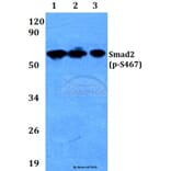 Anti-Smad2 (phospho-S467) Antibody from Bioworld Technology (BS4172) - Antibodies.com