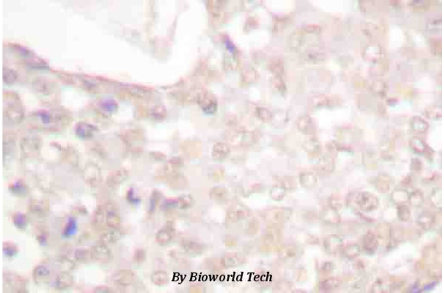 Anti-Smad2 (phospho-S467) Antibody from Bioworld Technology (BS4172) - Antibodies.com
