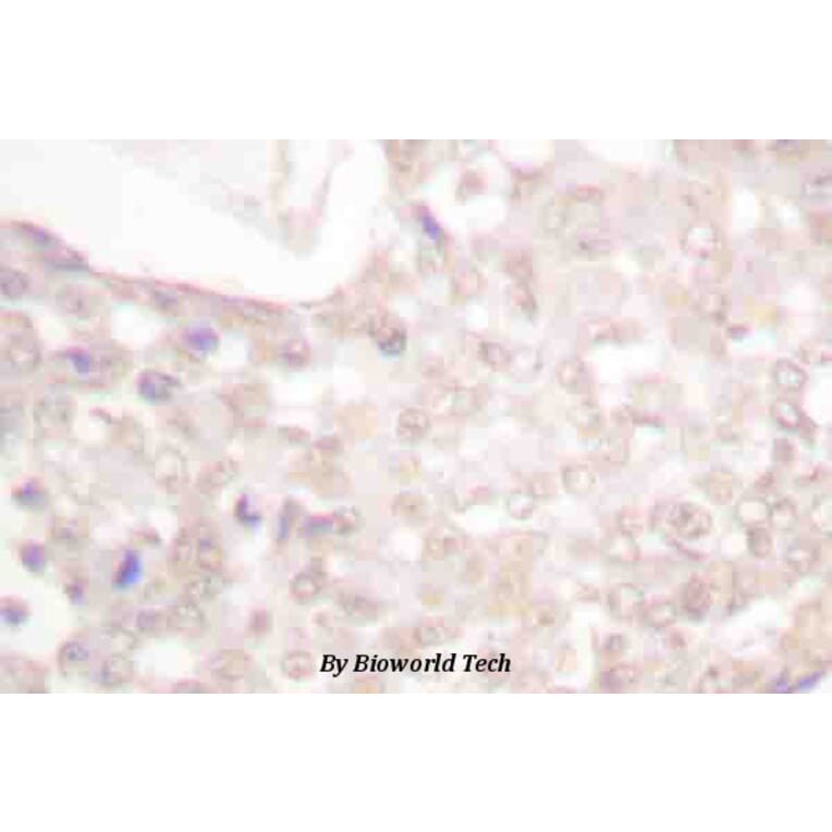 Anti-Smad2 (phospho-S467) Antibody from Bioworld Technology (BS4172) - Antibodies.com