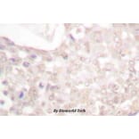 Anti-Smad2 (phospho-S467) Antibody from Bioworld Technology (BS4172) - Antibodies.com