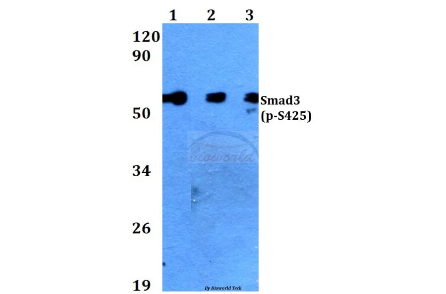 Anti-Smad3 (phospho-S425) Antibody from Bioworld Technology (BS4173) - Antibodies.com