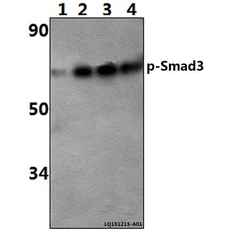 Anti-Smad3 (phospho-S425) Antibody from Bioworld Technology (BS4173) - Antibodies.com