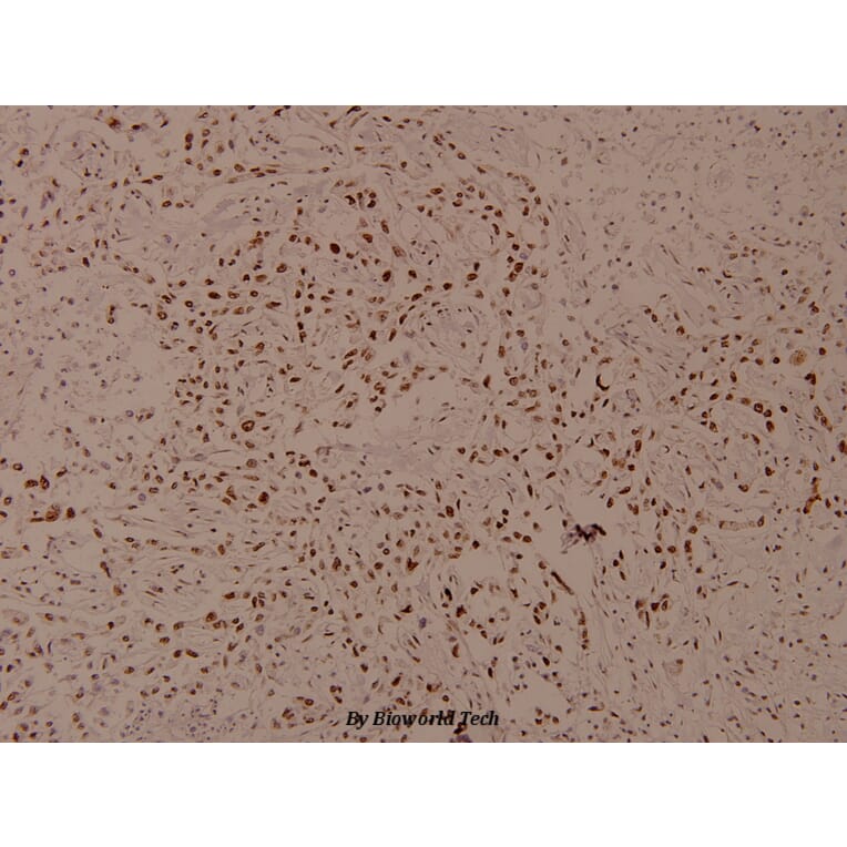 Anti-Smad3 (phospho-S425) Antibody from Bioworld Technology (BS4173) - Antibodies.com
