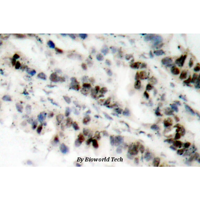 Anti-SMC 1 (phospho-S957) Antibody from Bioworld Technology (BS4174) - Antibodies.com