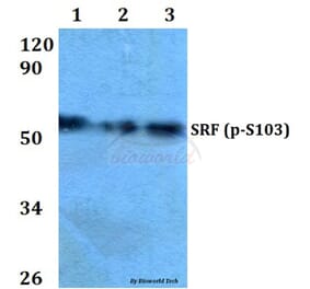 Anti-SRF (phospho-S103) Antibody from Bioworld Technology (BS4177) - Antibodies.com