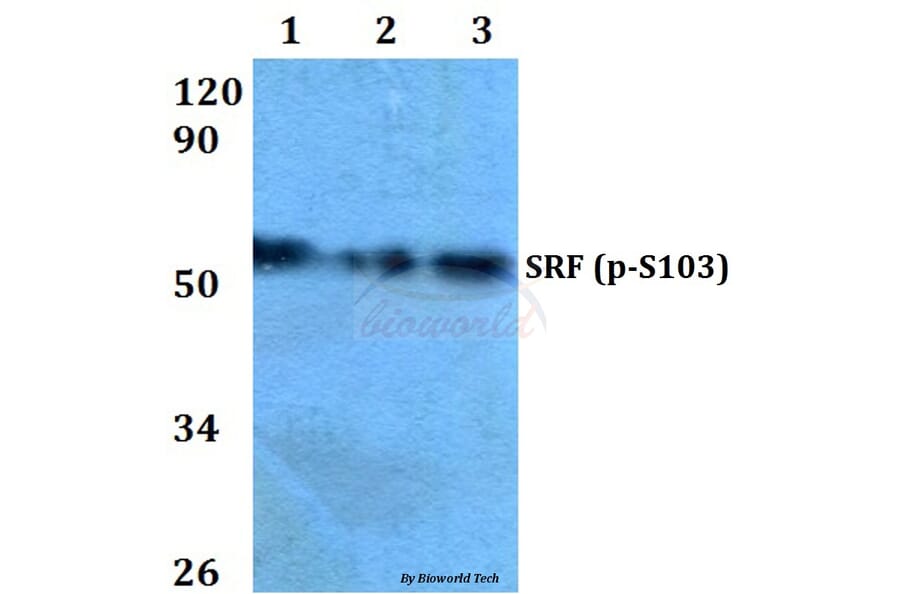Anti-SRF (phospho-S103) Antibody from Bioworld Technology (BS4177) - Antibodies.com