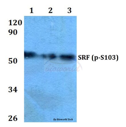 Anti-SRF (phospho-S103) Antibody from Bioworld Technology (BS4177) - Antibodies.com