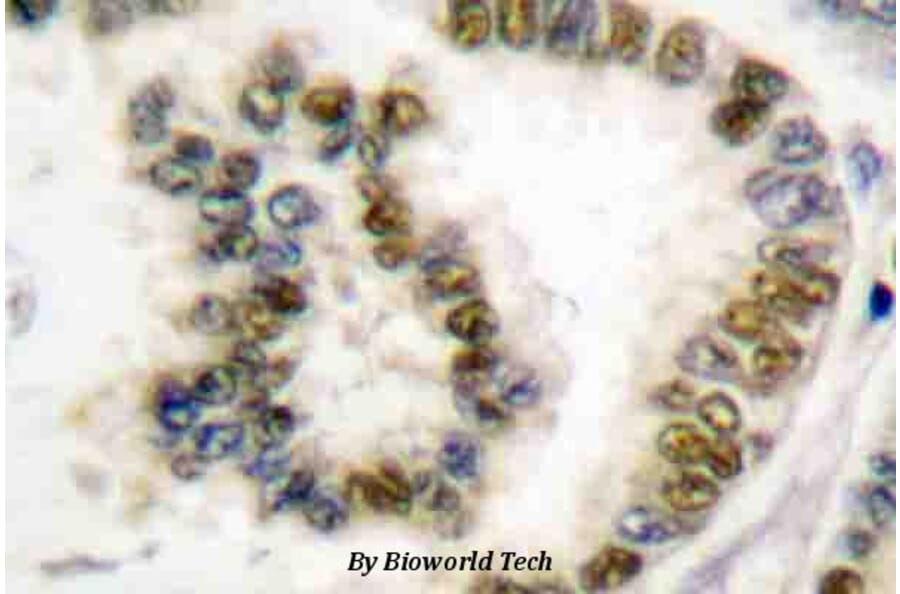 Anti-SRF (phospho-S103) Antibody from Bioworld Technology (BS4177) - Antibodies.com