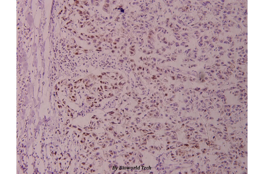 Anti-Stat3 (phospho-S727) Antibody from Bioworld Technology (BS4180) - Antibodies.com