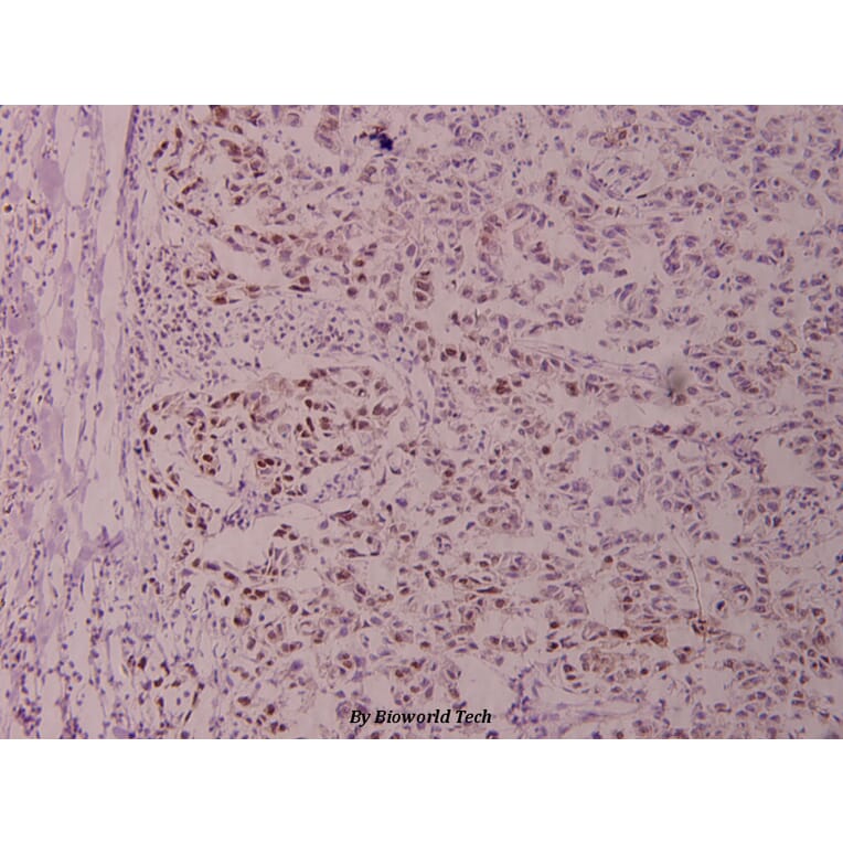 Anti-Stat3 (phospho-S727) Antibody from Bioworld Technology (BS4180) - Antibodies.com