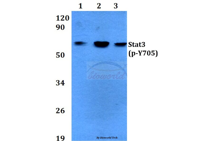 Anti-Stat3 (phospho-Y705) Antibody from Bioworld Technology (BS4181) - Antibodies.com