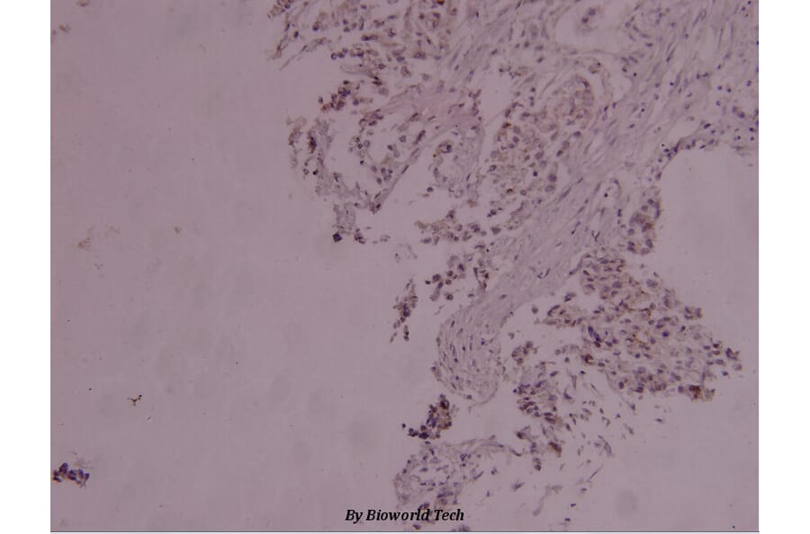 Anti-Stat3 (phospho-Y705) Antibody from Bioworld Technology (BS4181) - Antibodies.com