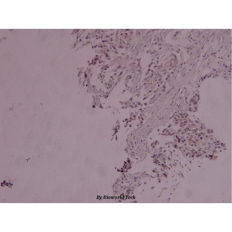 Anti-Stat3 (phospho-Y705) Antibody from Bioworld Technology (BS4181) - Antibodies.com