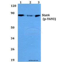 Anti-Stat4 (phospho-Y693) Antibody from Bioworld Technology (BS4183) - Antibodies.com