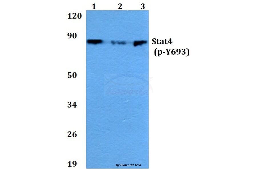 Anti-Stat4 (phospho-Y693) Antibody from Bioworld Technology (BS4183) - Antibodies.com