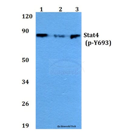 Anti-Stat4 (phospho-Y693) Antibody from Bioworld Technology (BS4183) - Antibodies.com