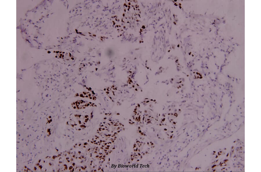Anti-Stat4 (phospho-Y693) Antibody from Bioworld Technology (BS4183) - Antibodies.com