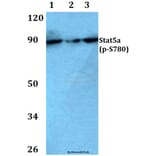 Anti-Stat5a (phospho-S780) Antibody from Bioworld Technology (BS4184) - Antibodies.com