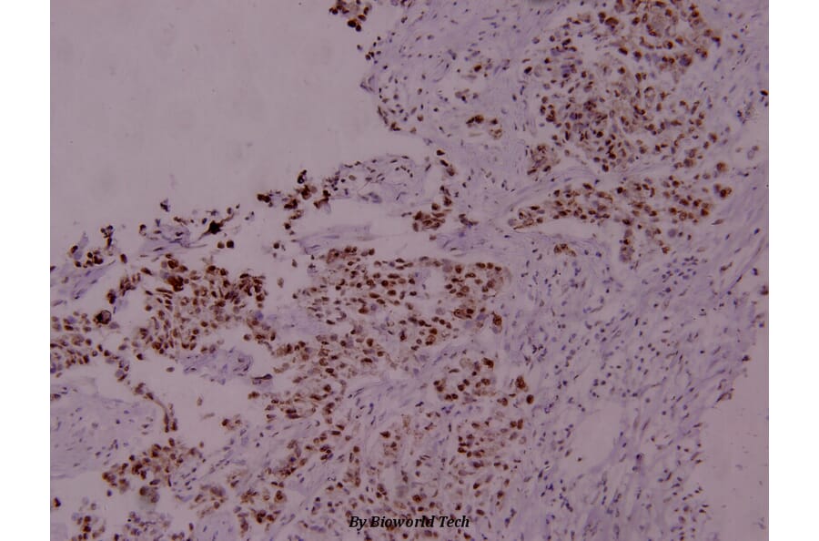 Anti-Stat5a (phospho-S780) Antibody from Bioworld Technology (BS4184) - Antibodies.com