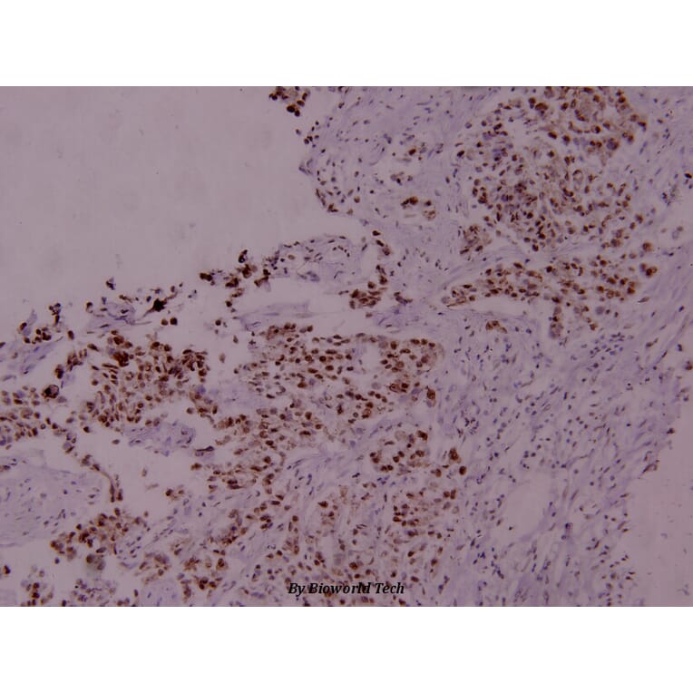 Anti-Stat5a (phospho-S780) Antibody from Bioworld Technology (BS4184) - Antibodies.com