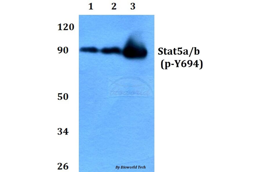 Anti-Stat5a/b (phospho-Y694) Antibody from Bioworld Technology (BS4185) - Antibodies.com