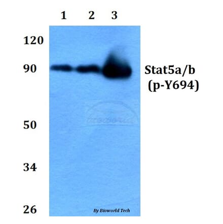 Anti-Stat5a/b (phospho-Y694) Antibody from Bioworld Technology (BS4185) - Antibodies.com