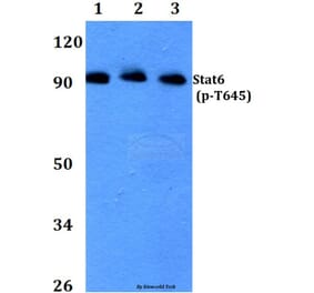 Anti-Stat6 (phospho-T645) Antibody from Bioworld Technology (BS4186) - Antibodies.com