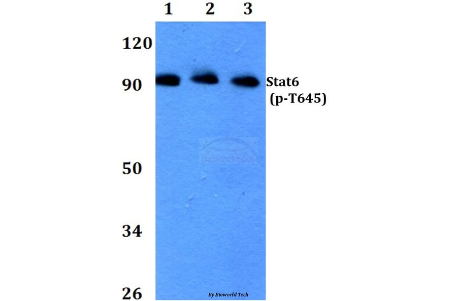 Anti-Stat6 (phospho-T645) Antibody from Bioworld Technology (BS4186) - Antibodies.com