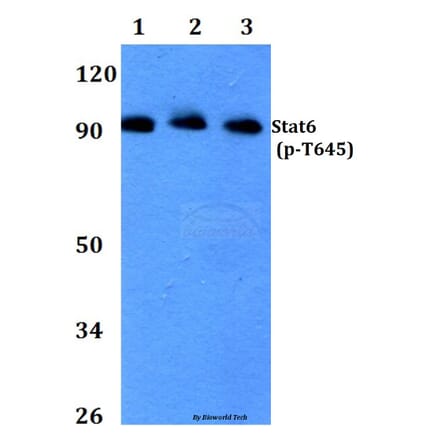 Anti-Stat6 (phospho-T645) Antibody from Bioworld Technology (BS4186) - Antibodies.com