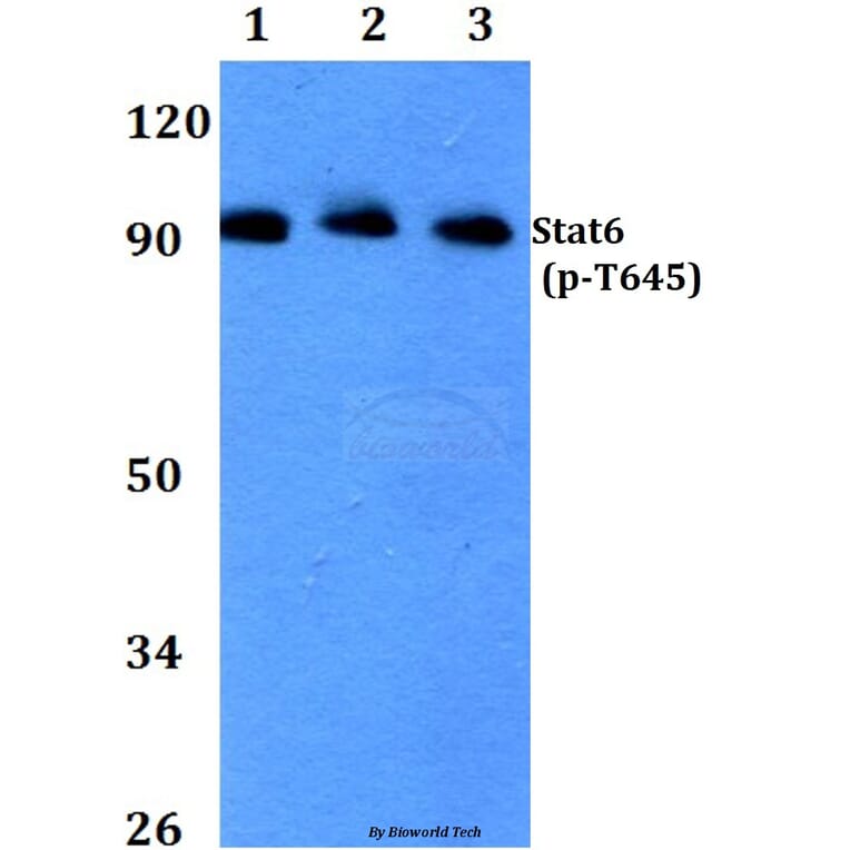 Anti-Stat6 (phospho-T645) Antibody from Bioworld Technology (BS4186) - Antibodies.com