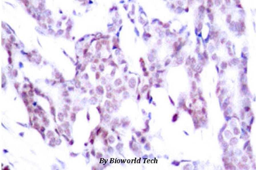 Anti-Stat6 (phospho-T645) Antibody from Bioworld Technology (BS4186) - Antibodies.com