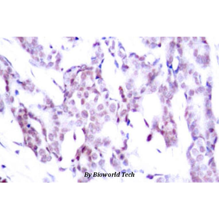 Anti-Stat6 (phospho-T645) Antibody from Bioworld Technology (BS4186) - Antibodies.com